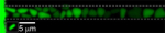 Experimental shot of  E. coli bacteria in a nanoslit. The illustration below left shows the normal cylindrical shape of these bacteria. The main figure shows the peculiar shapes of the flattened bacteria (Kavli TU Delft / Tremani).